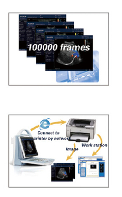 DCU12 portable full digital color doppler system