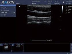 Strumento diagnostico a ultrasuoni Doppler a colori digitale DCU10