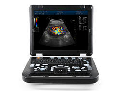 Strumenti diagnostici a ultrasuoni Doppler a colori digitali completi DCU30